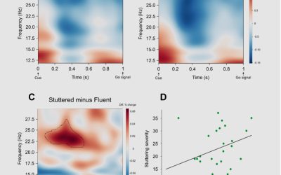 Reactive Inhibitory Control Precedes Stuttered Speech